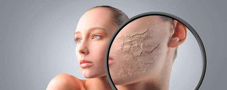 8 порад з догляду за сухою шкірою